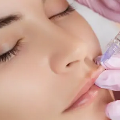 Dermal Fillers